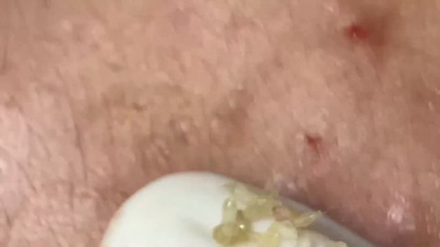 Enjoy Every Day With The Best Video Loan Nguyen Spa Official  2653