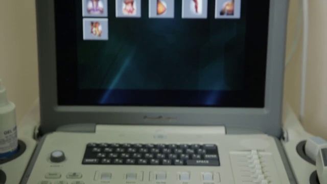 Sonoscape s6 pro - 01 Установка и подключение 720 смотреть онлайн