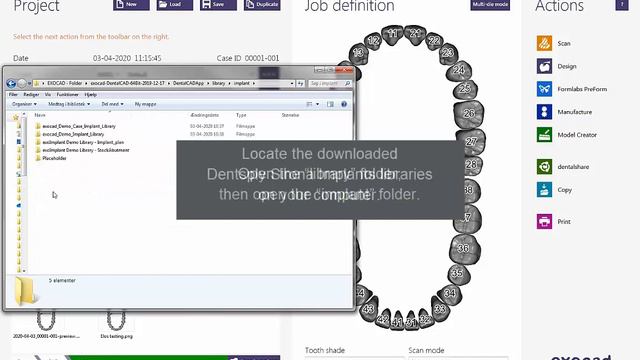 Dentsply Sirona Implants libraries - Exocad How to install смотреть онлайн
