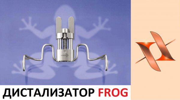 Ортоднтический аппарат Frog (Лягушка)