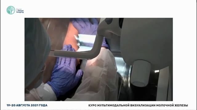 Мастер-класс контрастная двухэнергетическая спектральная маммографии CESM