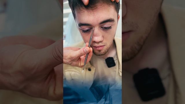 РИНОПЛАСТИКА В МАХАЧКАЛЕ - АЛИ РАДЖАБОВИЧ. Бесплатная консультация по воцап +79882925115 смотреть онлайн