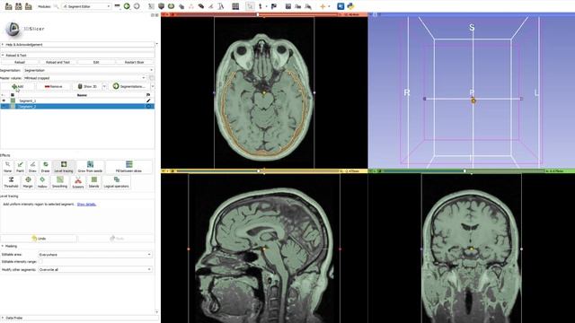 User Statistics - New module in 3D Slicer смотреть онлайн