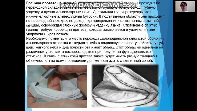 Клинико   лабораторные этапы изготавливания ПСПП