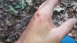 Укус Шершня. Шершни Из Гнезда Атакуют Мою Руку, Многочисленные Укусы Шершней. Гнездо Шершней !