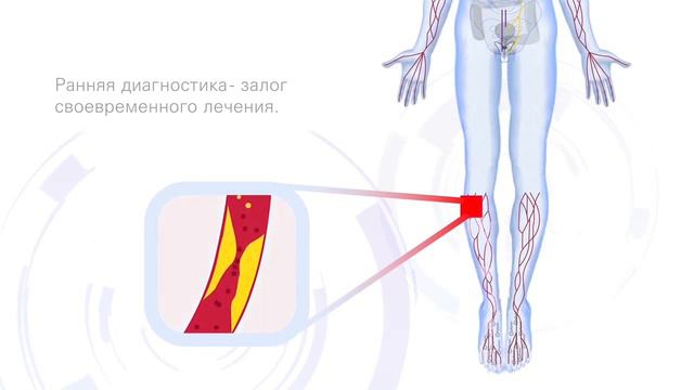 Комплексное исследование организма на новейшей американской системе «Марвел» Елец смотреть онлайн