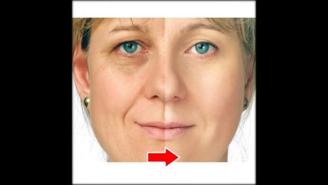 как омолодить кожу лица форум смотреть онлайн