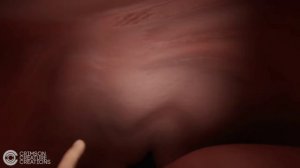Furry vore 10