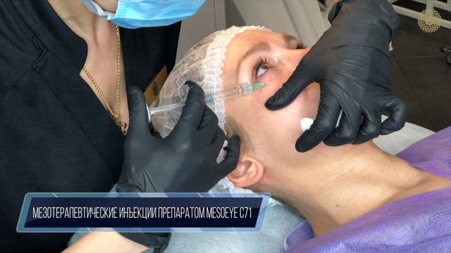 Мезотерапевтические инъекции препаратом MesoEye C71 смотреть онлайн