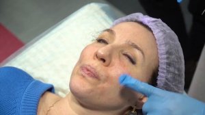 PDRN Millionaire и PDRN Mystic. Техника работы под углом 90° для лифтинга