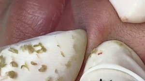 Relax Every Day With Sac Dep Spa #0211