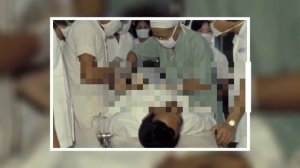 मुसलमान धर्म में खतना की प्रथा कब से और क्यों शुरू हुई ? | Circumcision In Islam Why