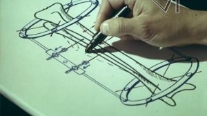 Аппарат Илизарова (фильм 1979 г.)