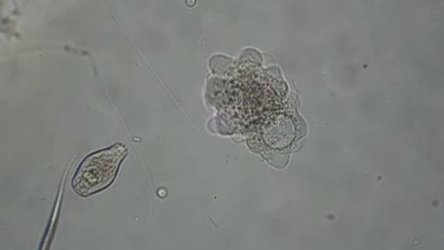 Амеба протей 600х смотреть онлайн