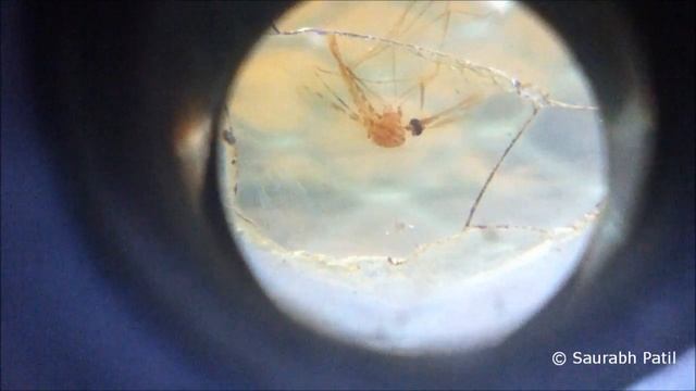 Anopheles mosquito under dissecting microscope смотреть онлайн