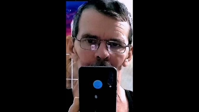 №728 исцеление таранной косточки у Сергей из Ростова на Дону смотреть онлайн