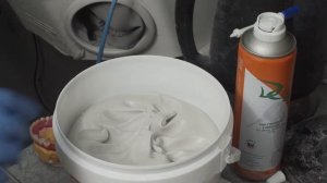 Изготовление акрилового протеза на балке из титана. Медицинский центр ул. Ярцевская 28