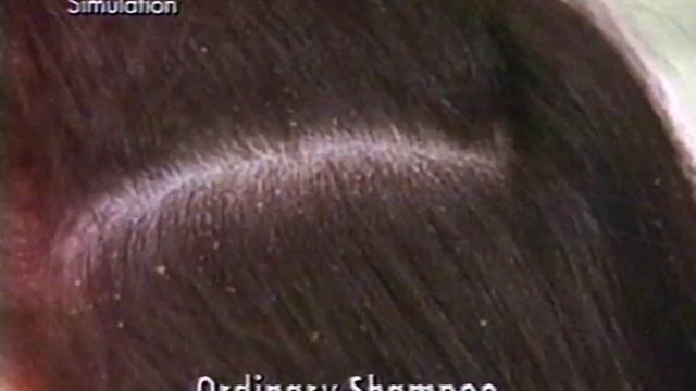 Head & Shoulders Shampoo Commercial 1994