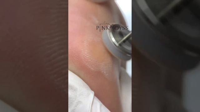 Избавимся от мозоли с помощью пенки #педикюр #pedicura #pedicures #pedicuremedicure #pedicure смотреть онлайн