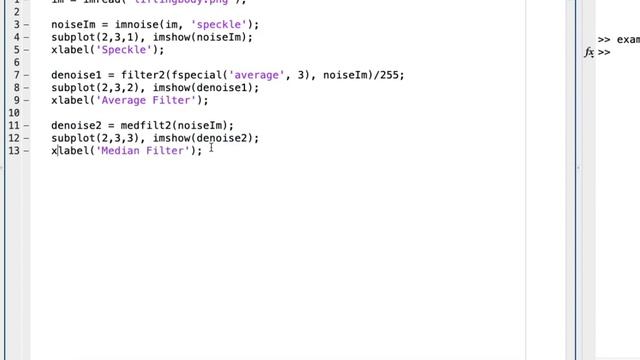 Matlab Speckle Noise Removal смотреть онлайн