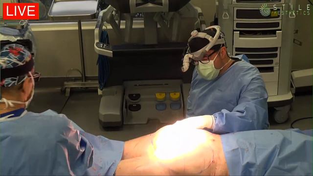 BBL | Brazilian Butt Lift