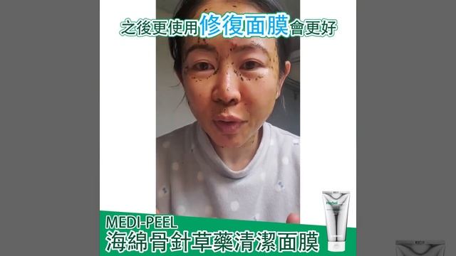 韓國 | Medipeel 海藻矽針嫩膚面膜 | 凹凸洞 | 去死皮 | 去角質 | 嫩膚 | 平滑 | 海藻 | 淡化瑕疵 | 清潔 | 矽針 | 粉刺 | 粗毛孔 | 美白 | 草藥