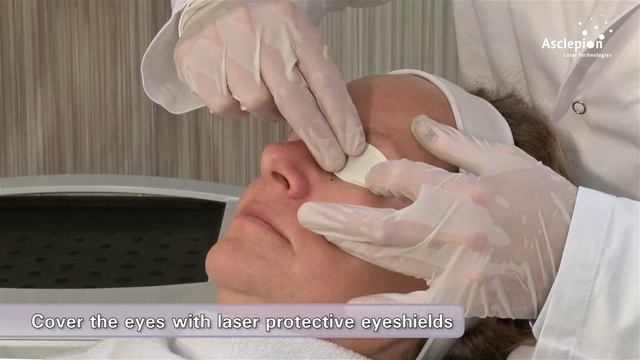 MeDioStar NeXT PRO - Training video for skin rejuvenation and whitening from Asclepion смотреть онлайн