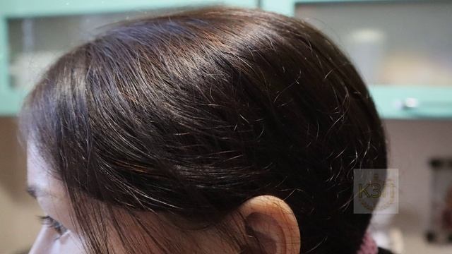 Перхоть сыпалась снегом сделала эту маску и все как рукой сняло! Как избавиться от перхоти? смотреть онлайн