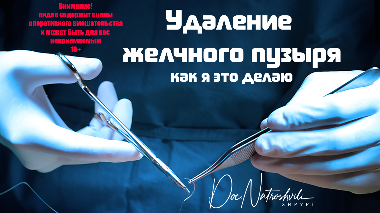Удаление желчного пузыря - как я это делаю смотреть онлайн