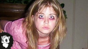 ЕЁ СВОРОВАЛИ ОБЕЗЬЯНЫ. ВОТ ЧТО С НЕЙ СТАЛО ЧЕРЕЗ 30 ЛЕТ [Белый кот]