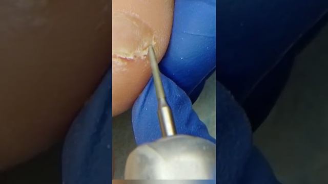 ПРОБЛЕМА ВСЕХ МИЗИНЦЕВ смотреть онлайн