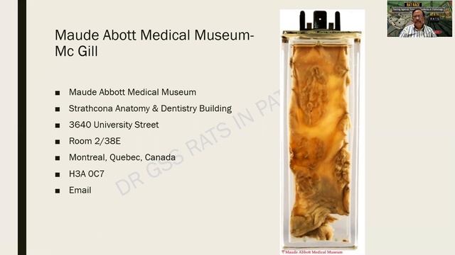 Ulcers of Intestine | G.I.T | R.A.T.S in Pathology | Dr.G.Shivashekar | University Questions смотреть онлайн