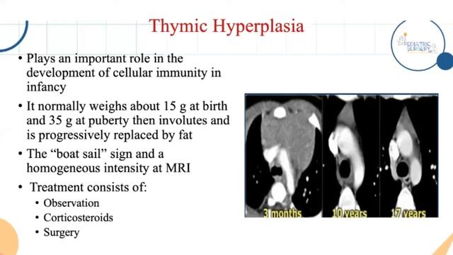 Mediastinal Mass | Dr. Ali Assiri | 3rd Pediatric Surgery Review Course смотреть онлайн
