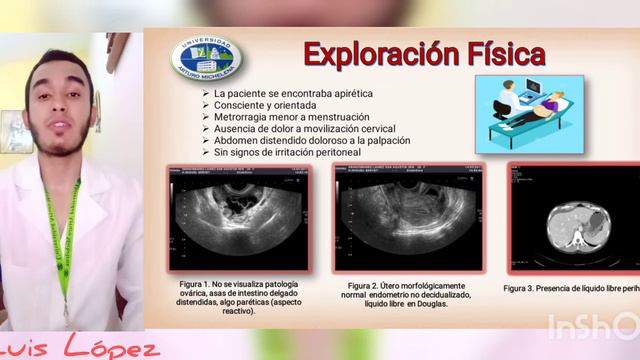Caso Clínico 🤓 Chlamydia Trachomatis 🦠 смотреть онлайн