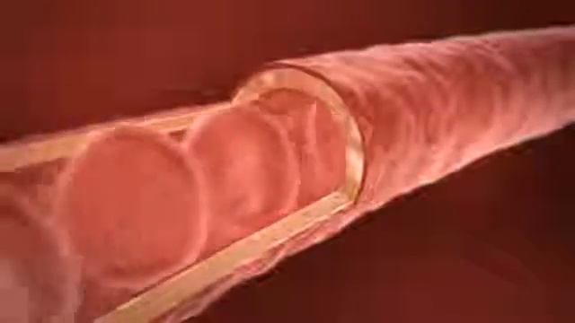 Aloe Vera LR. Зачем нужен питьевой гель алоэ вера смотреть онлайн