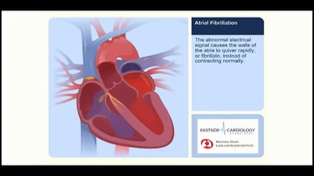 4.2 ECG video TC.mov смотреть онлайн