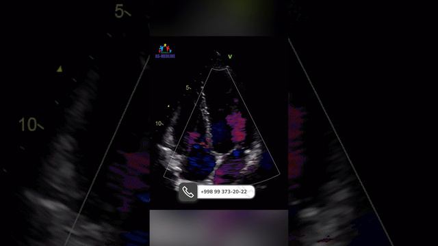 Homilador Ayollar Dopler Tekshiruvidan O'tishi Shartmi?