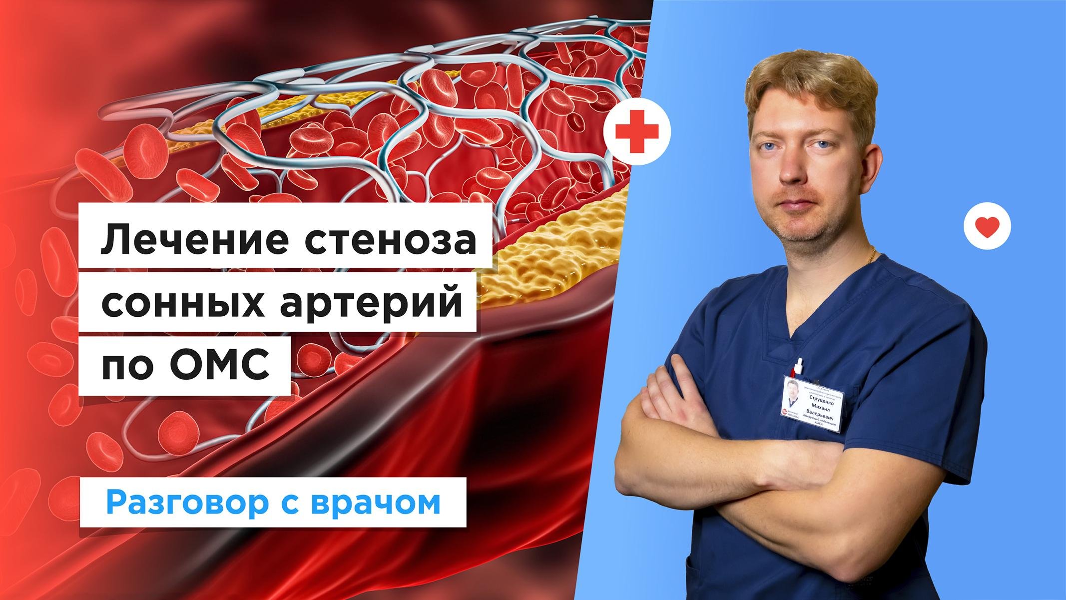 Стеноз сонных артерий бесплатно по полису ОМС смотреть онлайн