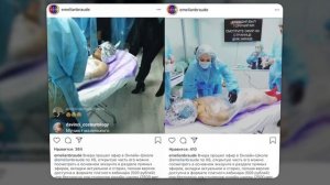 ПРОЩАЙ ЛИЦО! | Трэш косметология в инстаграм