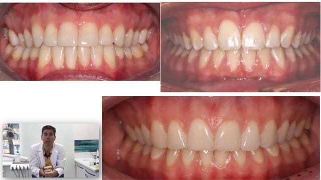 Идеальные зубы! смотреть онлайн