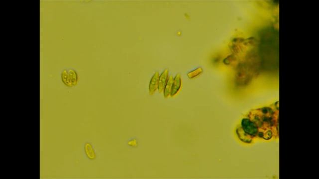 Scenedesmus Obliquus