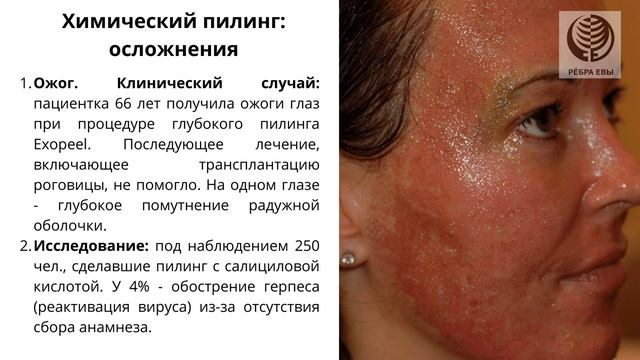 Лекция Лики Зауэр "Железная дева: опасные бьюти-практики" смотреть онлайн