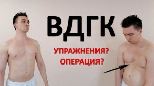 ВДГК (впалая грудь). Какие упражнения делать? Нужна ли операция?