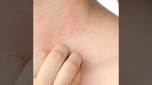 Aceite Esencial de Lavanda Just смотреть онлайн
