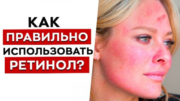 Использовать ретинол — ОПАСНО?! / Как ПРАВИЛЬНО пользоваться косметикой с ретинолом?