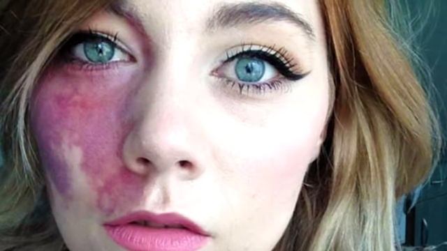 8 НЕОБЫЧНЫХ ЛЮДЕЙ, КОТОРЫЕ ГОРДЯТСЯ СВОИМИ НЕДОСТАТКАМИ смотреть онлайн