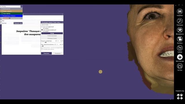 FaceScan/Скан лица в стоматологическом планировании. Digital Dental Plan/ To Make Project/Exocad