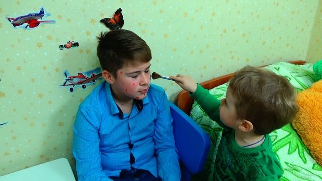 ПРЫЩИ ИСПОРТИЛИ мое СВИДАНИЕ!!! смотреть онлайн