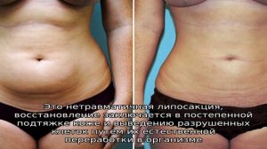 Правила реабилитации после липосакции