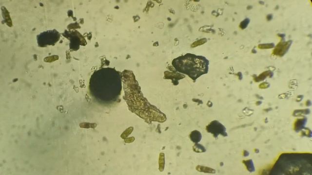 Тихоходка  (Tardigrade, Water Bears) из мха с поваленного дерева под микроскопом, 100 крат